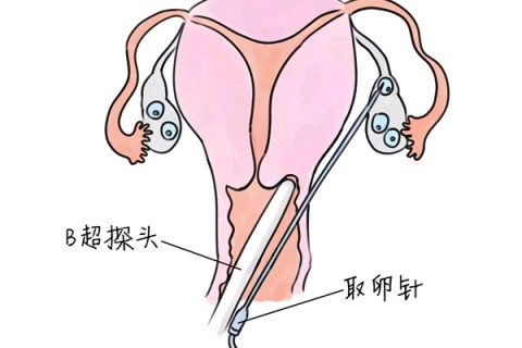 http://haerbin.vdtfzz.com/post/205.html|哈尔滨供卵助孕