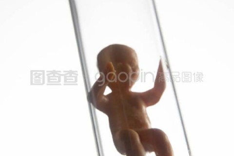 http://haerbin.vdtfzz.com/post/197.html|哈尔滨试管助孕